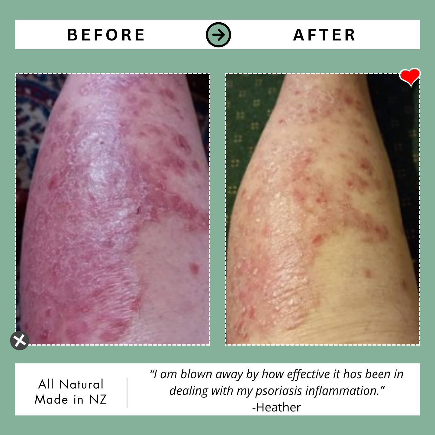 Kawakawa Balm - Winner, Best SOS/Healing Balm