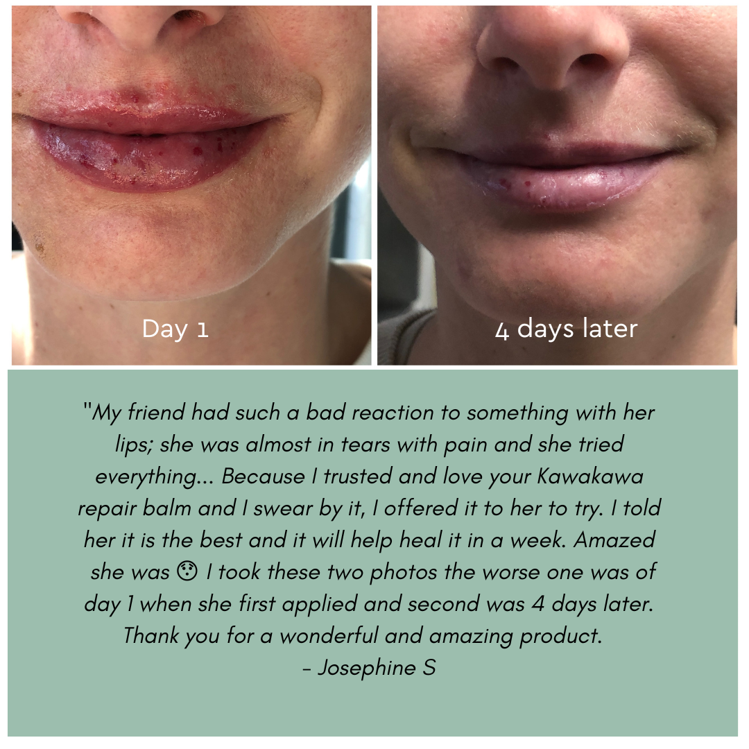 Kawakawa Balm - Winner, Best SOS/Healing Balm