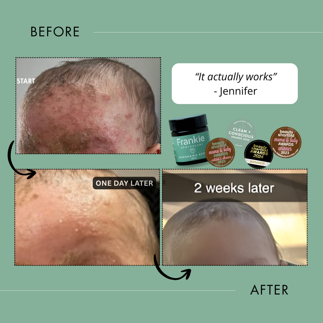 Kawakawa Balm - Winner, Best SOS/Healing Balm 2024